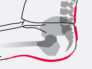 4 - Duora2 - Pelvic Support