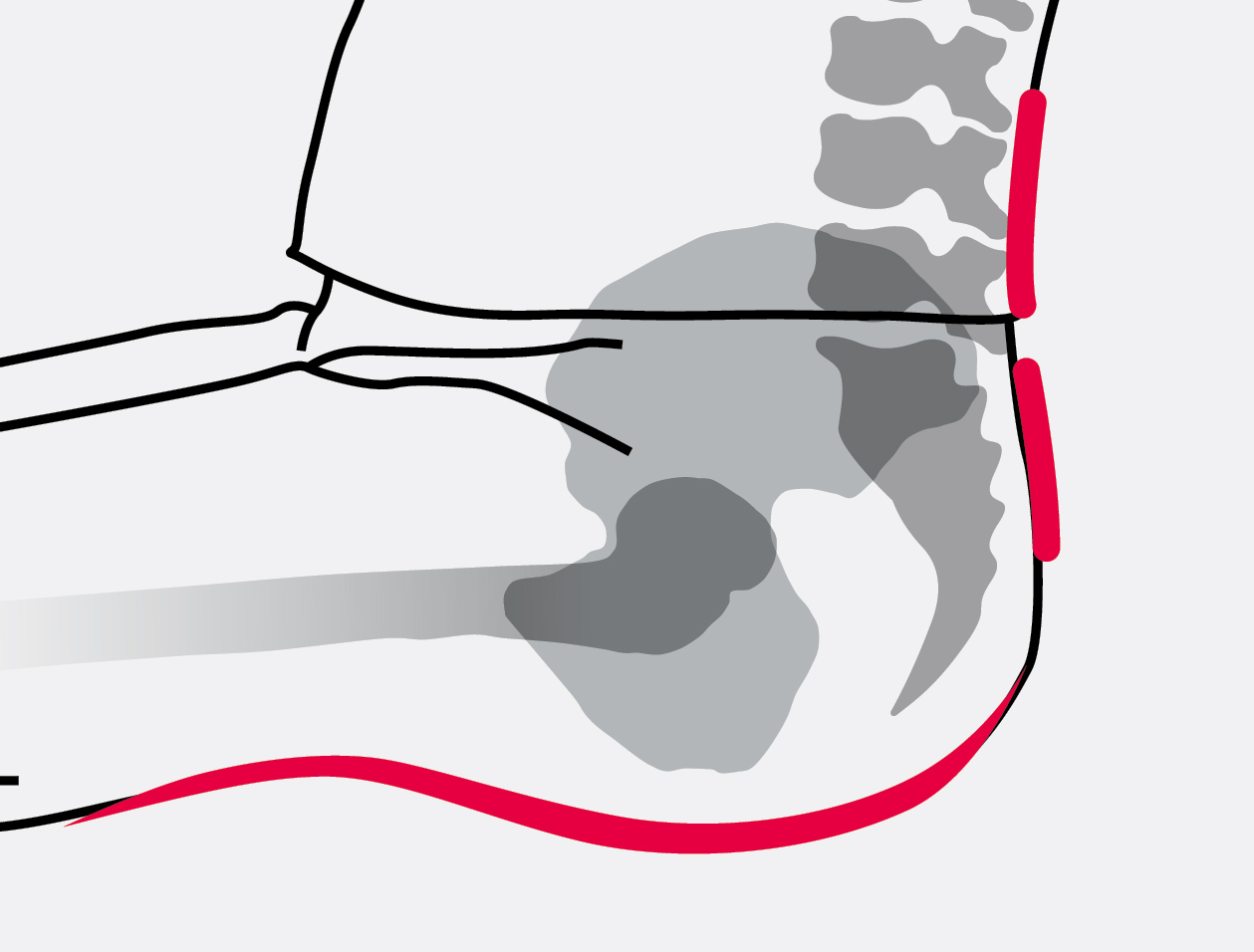 4 - Duora2 - Pelvic Support